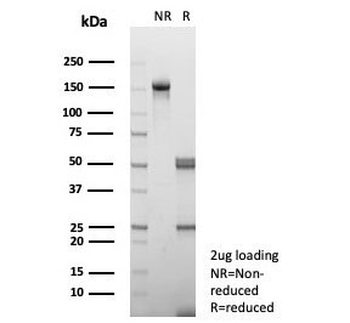 IL15 Antibody