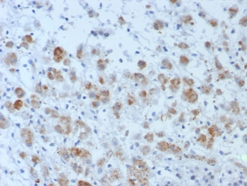 IL15 Antibody