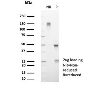 IL15 Antibody