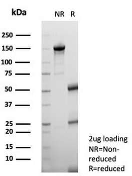 IL-2 Antibody