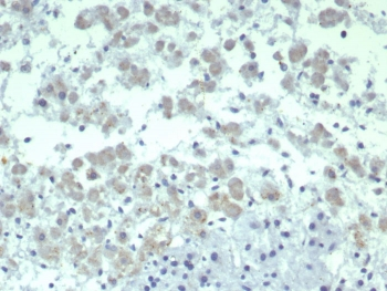 IL-2 Antibody