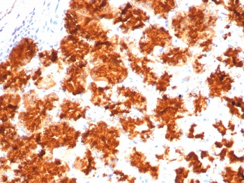 IL-2 Antibody
