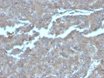 IL-2 Antibody