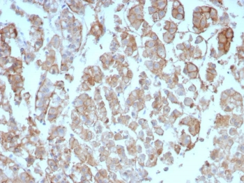 IL-2 Antibody