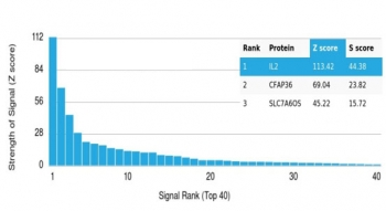 IL-2 Antibody