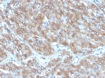 IL-2 Antibody