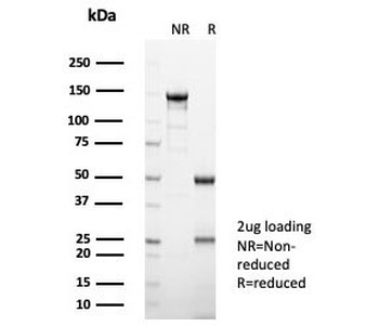 IL-2 Antibody