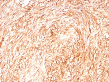 c-Kit Antibody / CD117 / SCFR