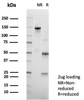 PDGFRA Antibody / Platelet Derived Growth Factor Receptor alpha