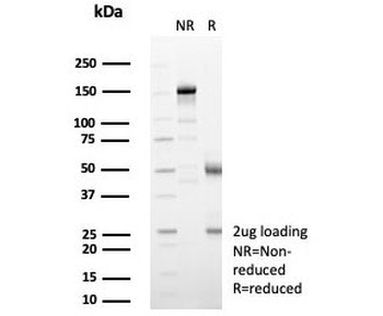 IL-2 Antibody
