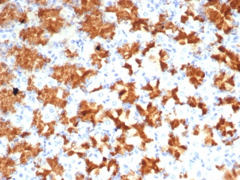 IL-2 Antibody