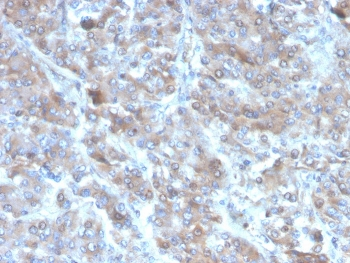 IL-2 Antibody