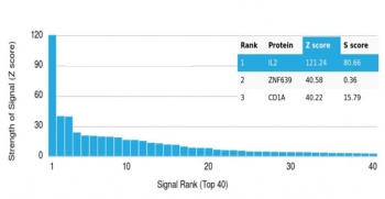 IL-2 Antibody