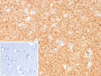 PGP9.5 Antibody / UchL1