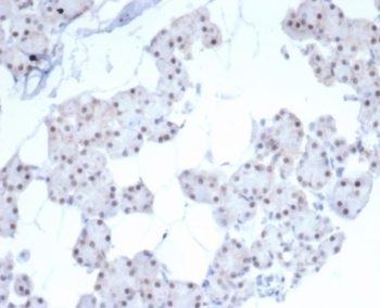 Paired-like homeobox 2B Antibody / PHOX2B