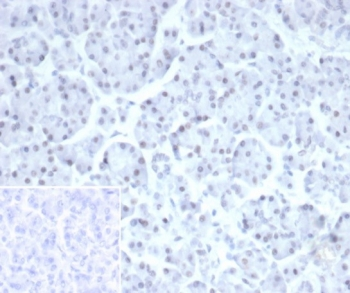 PHOX2B Antibody