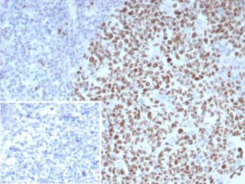 Bcl-6 Antibody / B-Cell Lymphoma 6 Protein