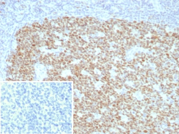 Bcl-6 Antibody / B-Cell Lymphoma 6