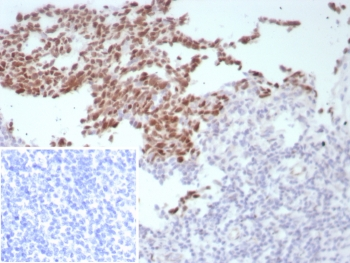 B-Cell Lymphoma 6 Antibody / BCL6