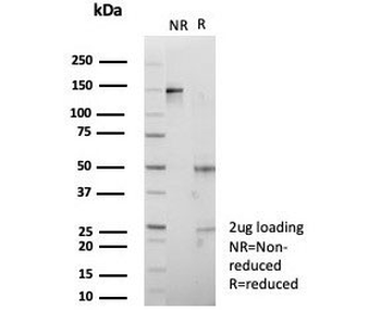IGF2BP2 Antibody