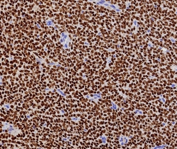 FOXL2 Antibody