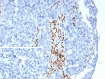 FOXL2 Antibody