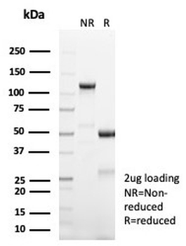 FOXL2 Antibody