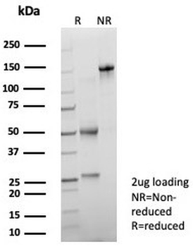 PSAP Antibody / Prostate Specific Acid Phosphatase