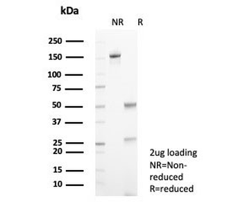 Transferrin Antibody / TF