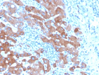 Transferrin Antibody / TF
