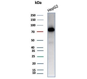Transferrin Antibody / TF