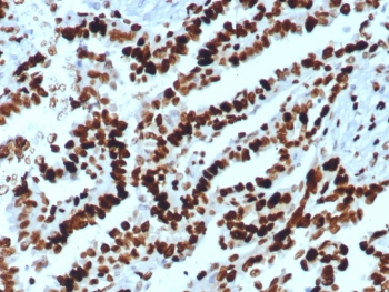 MCM2 Antibody
