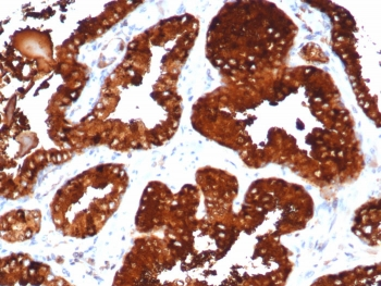 ZXDC Antibody / ZXD-like zinc finger protein