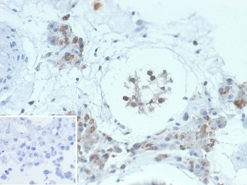 HGAL Antibody / GCSAM / GCET2