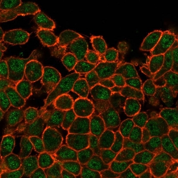 SATB1 Antibody / Special AT-rich sequence-binding protein 1