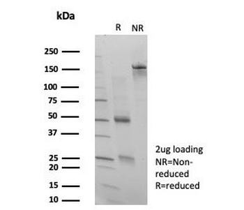 SATB1 Antibody / Special AT-rich sequence-binding protein 1