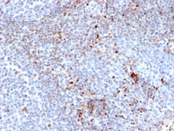 SATB1 Antibody / Special AT-rich sequence-binding protein 1