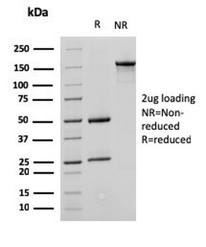 SATB1 Antibody / Special AT-rich sequence-binding protein 1