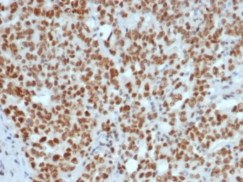 MLH1 Antibody / MutL Homolog 1