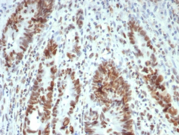 MLH1 Antibody / MutL Homolog 1