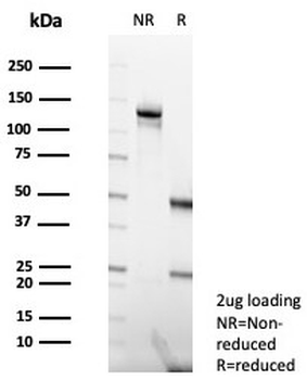 MLH1 Antibody / MutL Homolog 1