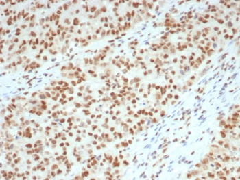 MLH1 Antibody / MutL Homolog 1