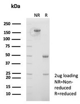 MLH1 Antibody / MutL Homolog 1