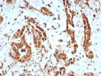 BRCA1-Associated Protein 1 Antibody / BAP1