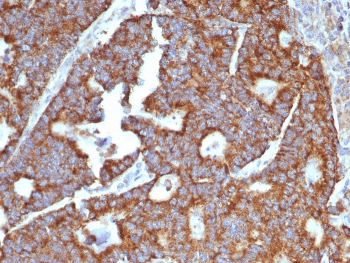 Transferrin Antibody