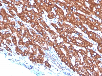 Transferrin Antibody