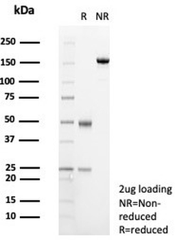 Transferrin Antibody