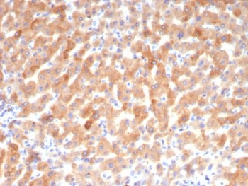 Transferrin Antibody / TF