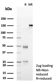 Transferrin Antibody / TF