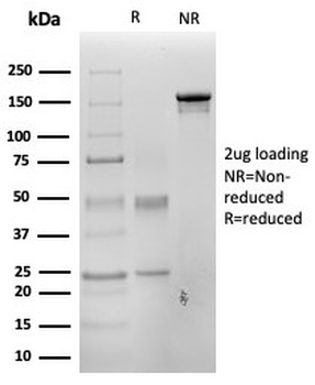 PAX3 Antibody / Paired box 3